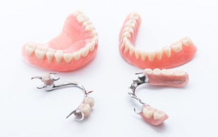 Common Problem with Dentures
